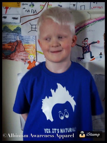 ‘Yes it’s Natural’ Albinism Awareness Boys T-Shirt
